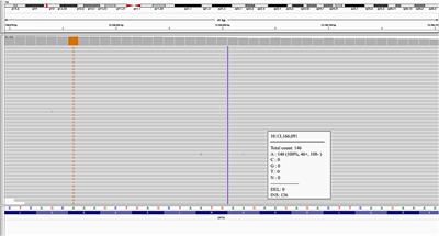 Novel Optineurin Frameshift Insertion in a Family With Frontotemporal Dementia and Parkinsonism Without Amyotrophic Lateral Sclerosis